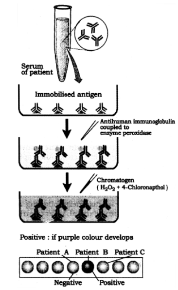 ELISA (Enzyme-Linked Immunosorbant Assay)