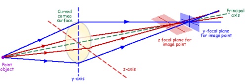 what is hyperopia