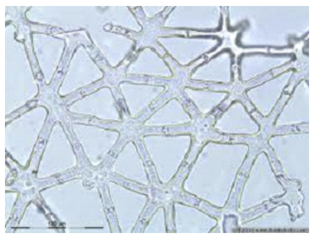 Stellate Parenchyma